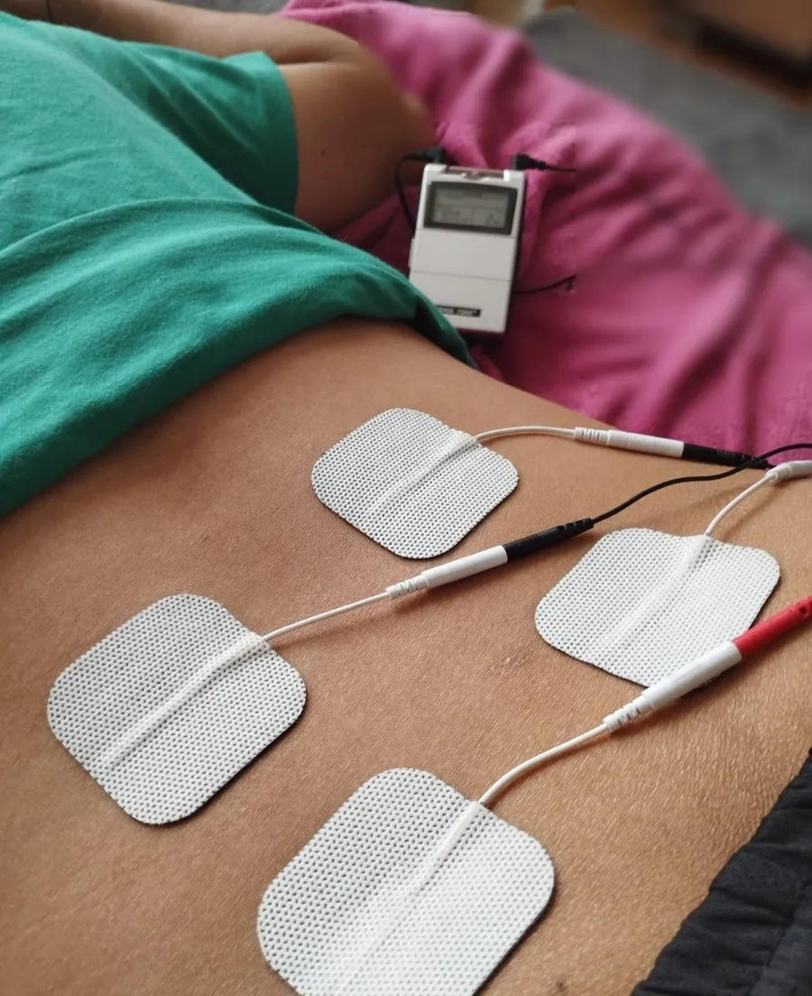 Electrodos de electroterapia en la zona lumbar de un paciente