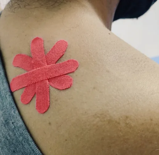 Aplicación de kinesiotape rosado en el hombro
